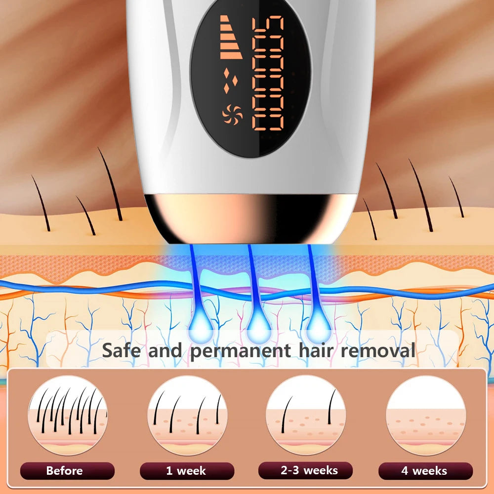 Professional IPL Laser Hair Remover 990000 Flashes for Women & Men - Painless, Permanent Hair Removal for All Body Areas
